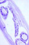 immitis C 14 sera from clinically healthy humans living in areas free from D.immitis The Wolbachia/filarial worms symbiosis is obligate.