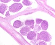 A typical effect of tetracycline treatment on filarial nematodes: inhibition of embryogenesis (infertility) u u Brugia pahangi control (female) Brugia pahangi treated (female) Effects of