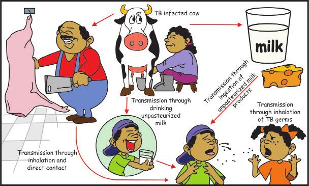 animals/or animal by-products Bovine tuberculosis is caused by Mycobacterium bovis (M. bovis), a member of the complex species. The primary bacterium that causes tuberculosis in humans is M.