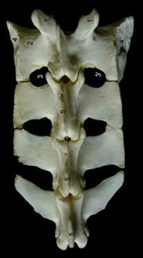 Tobechukwu et al 226 Figure 9. SACRUM, dorsal view 1, Cranial articular surface; 2, Wing of sacrum; 3, 3, Foramen; 4, Auricular surface; 5, Spinous processes.