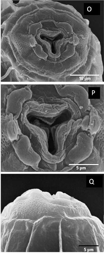 Fig. 2-3b. Scanning electron microscopy of Syphacia (Syphacia) rifaii collected from Bunomys chrysocomus in Central Sulawesi.