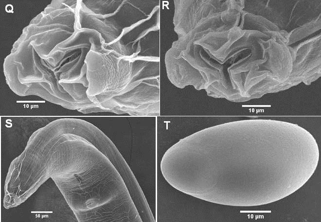 Fig. 2-7c. Scanning electron microscopy of Syphacia maxomyos collected from Maxomys musschenbroekii in Sulawesi, Indonesia.