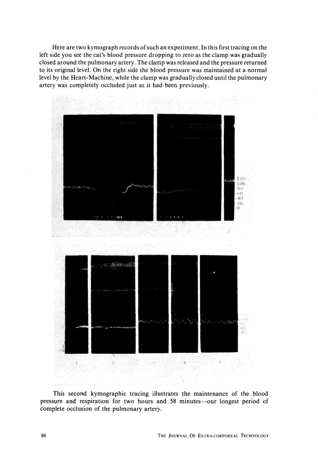 Here are two kymograph records of such an experiment.
