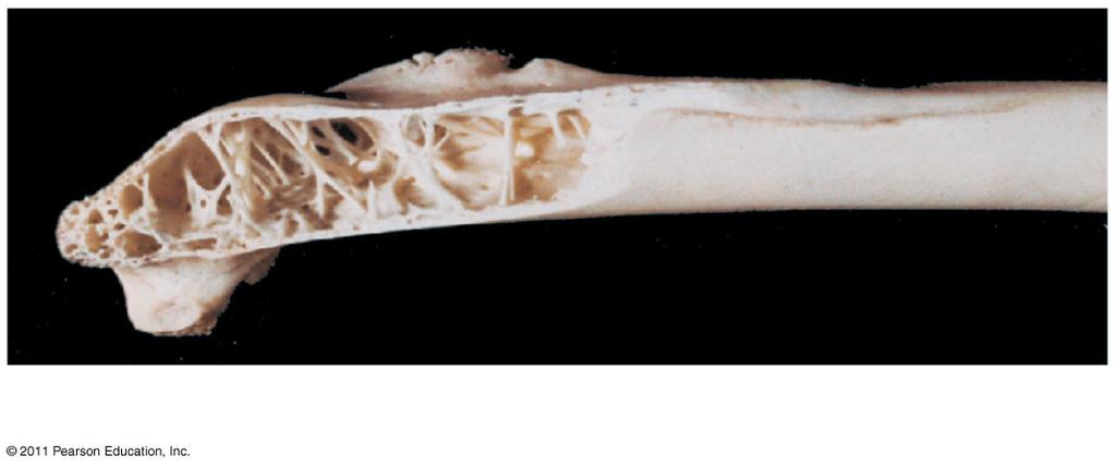 Figure 34.30b (b) Bone structure Figure 34.