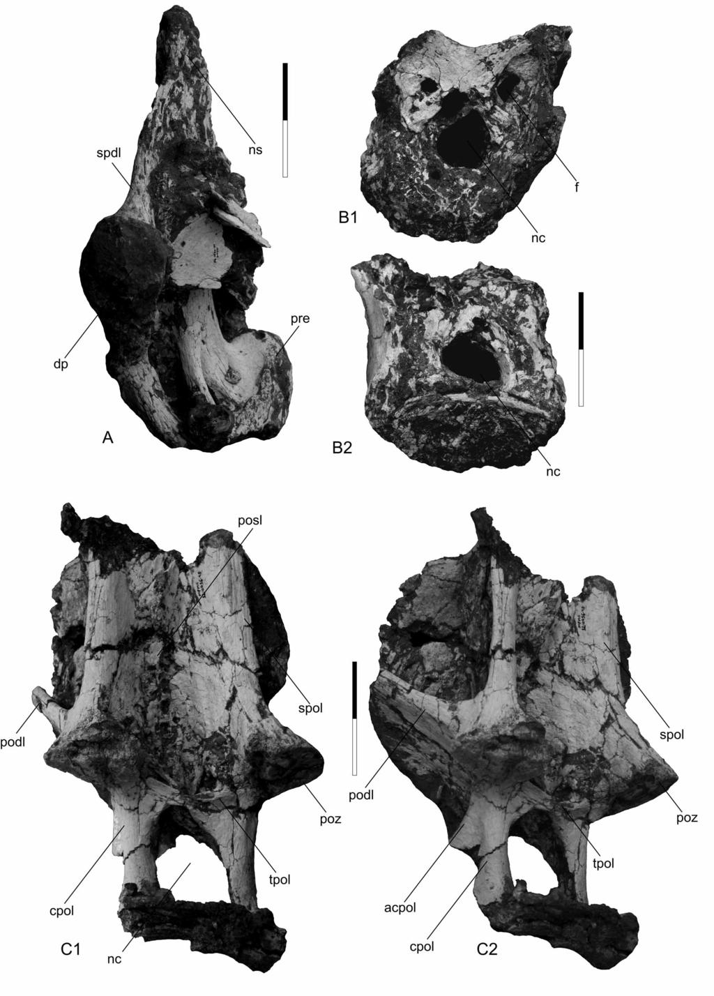 FIGURE 3. Aeolosaurus maximus sp. nov., holotype (MPMA 12-0001-97). A, anterior dorsal vertebra in right lateral view.