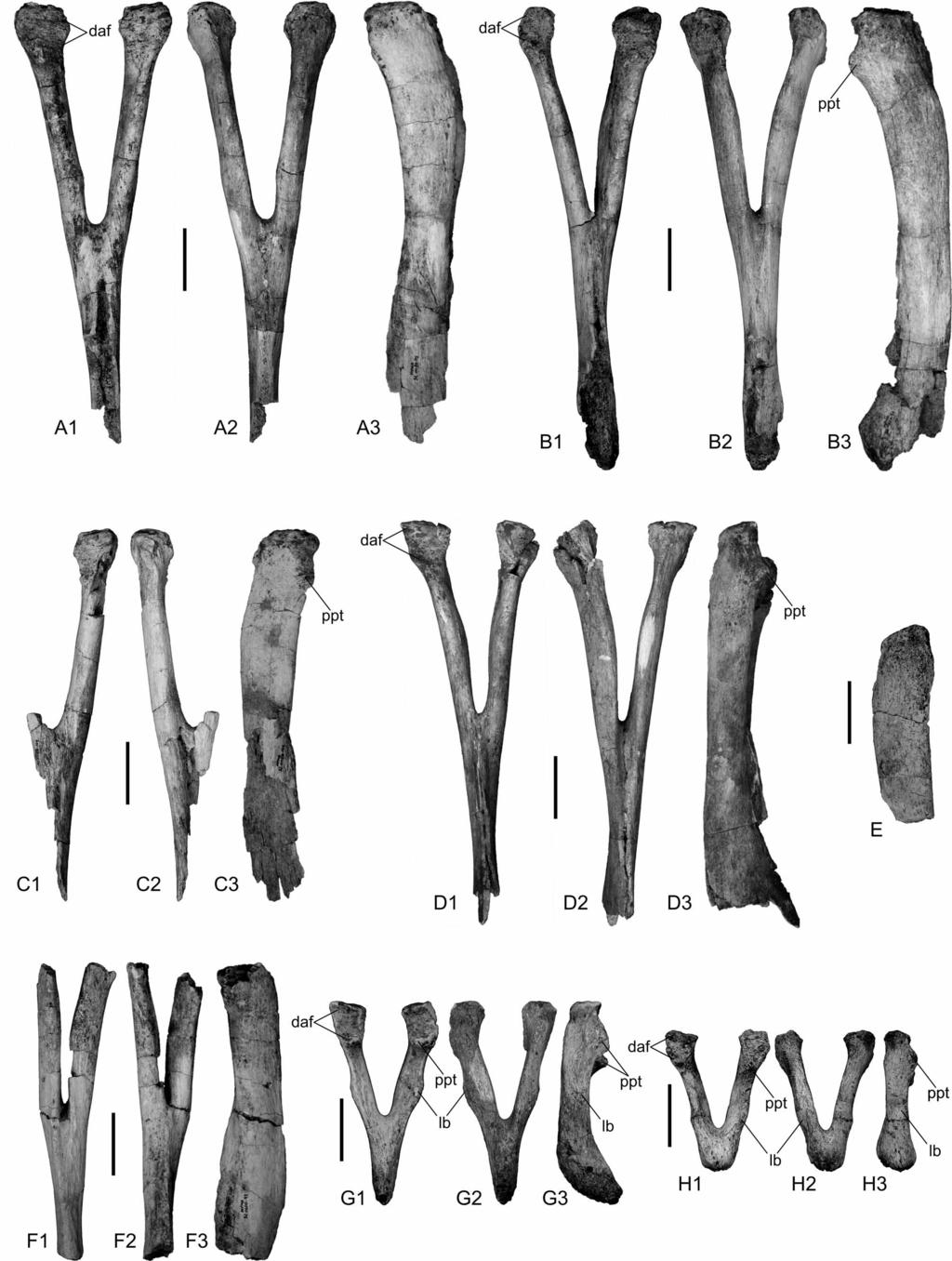 FIGURE 7. Aeolosaurus maximus sp. nov., holotype, haemal arches (MPMA 12-0001-97). A F, anterior haemal arches in posterior, anterior, and lateral views.