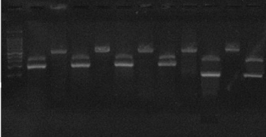 H. Mirahmadi, P. Bigleri, S. Sekandarpour, M. J. Modrek & R. Shafiei RESULTS Fig. 2. Cutting sites of RsaI restriction enzyme on A) F. hepatica, B) F. gigantica. lated to Fasciola spp.