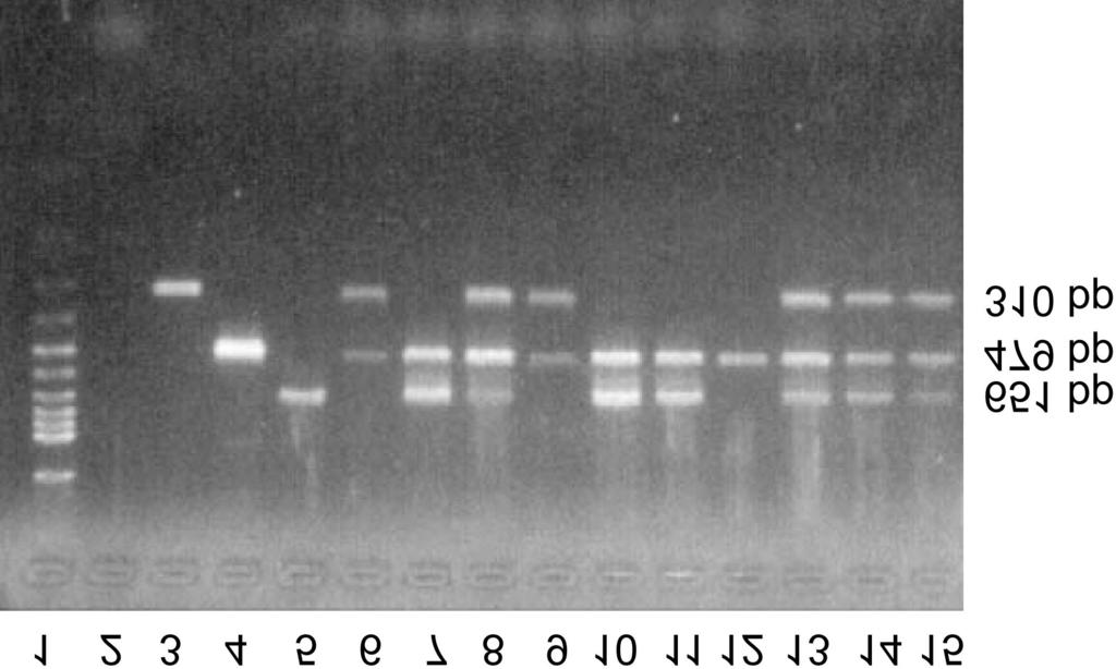 356 LEE et al. especially a serious problem in Korea due to its high incidence. Fig.. The electrophoresis patterns of multiplex-pcr products on the agarose gel.