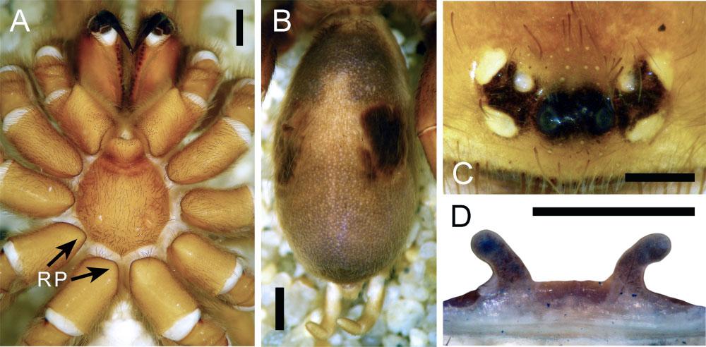 A, prosoma, ventral view showing the retrolateral projection of the coxa (RP) on coxae of all legs (arrows show this feature only on coxa of third and fourth legs). B, opisthosoma, dorsal view.