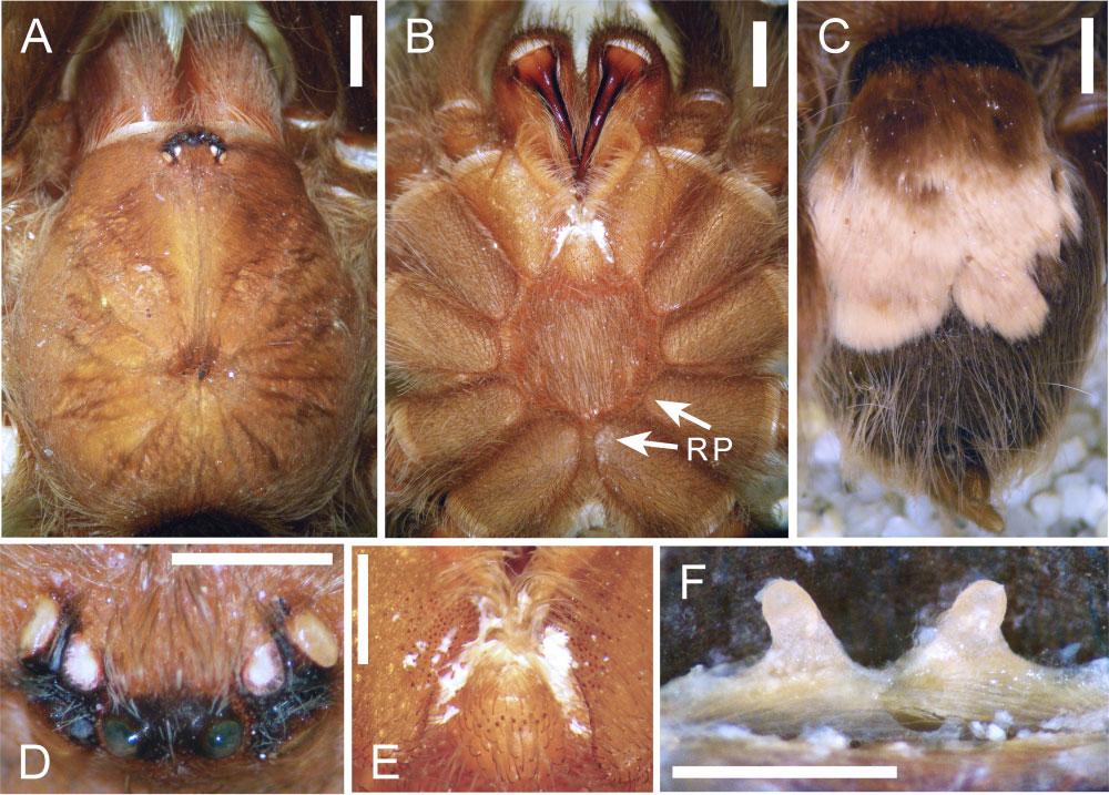 B, prosoma, ventral view showing the retrolateral projection of the coxa (RP) on coxae of all legs (arrows show this feature only on coxa of third and fourth legs). C, opisthosoma, dorsal view.
