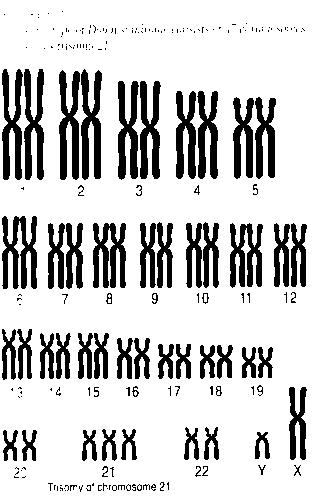 18. If a person has the genotype I A i, what is their blood type? a. O b. B c. AB d. A 19. In a pedigree circles represent and squares represent. a. Females; males b. Males; females c.
