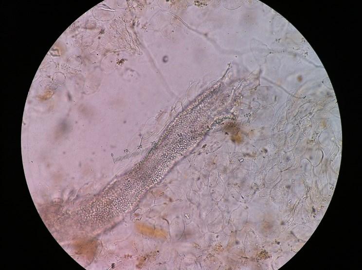 Figure 2. Hair infected with large arthroconidia in a cow with T. verrucosum infection. Microscopic observation after NaOH digestion (magnification 10 X). Figure 3. Chains of arthroconidia of T.
