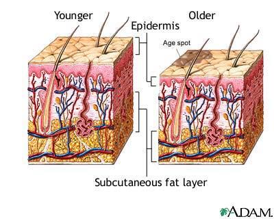 Skin Alterations with Age Aging: Flattening f dermoepidermal junction Decrease in thickness of deep dermal papillae Reduction