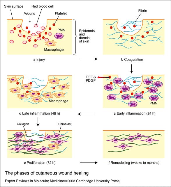Wound Healing Initial stage of Bleeding (Hemostasis) Enzyme release Proliferation of PMN, Platelets, Macrophage, RBCs Inflammatory Phase: (6hrs to 3 days) Granulocyte Activity Fibrin layer,