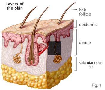 Anatomy of Skin Epidermis Basal Layer Keratinized or horny layer