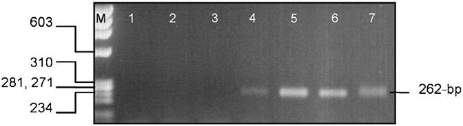 Molecular characterization of A. phagocytophilum in Egyptian R. sanguineus 191 Sequence analysis A BLAST search was performed (http://www.ncbi.nlm.nih.