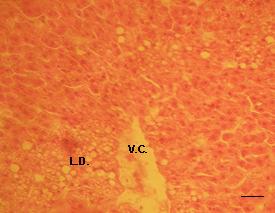 05 Histological picture of the livers in the experimental poultry showed significant diversity. A part of the liver parenchyma has a structure similar to the birds from the control group (Figure 1).