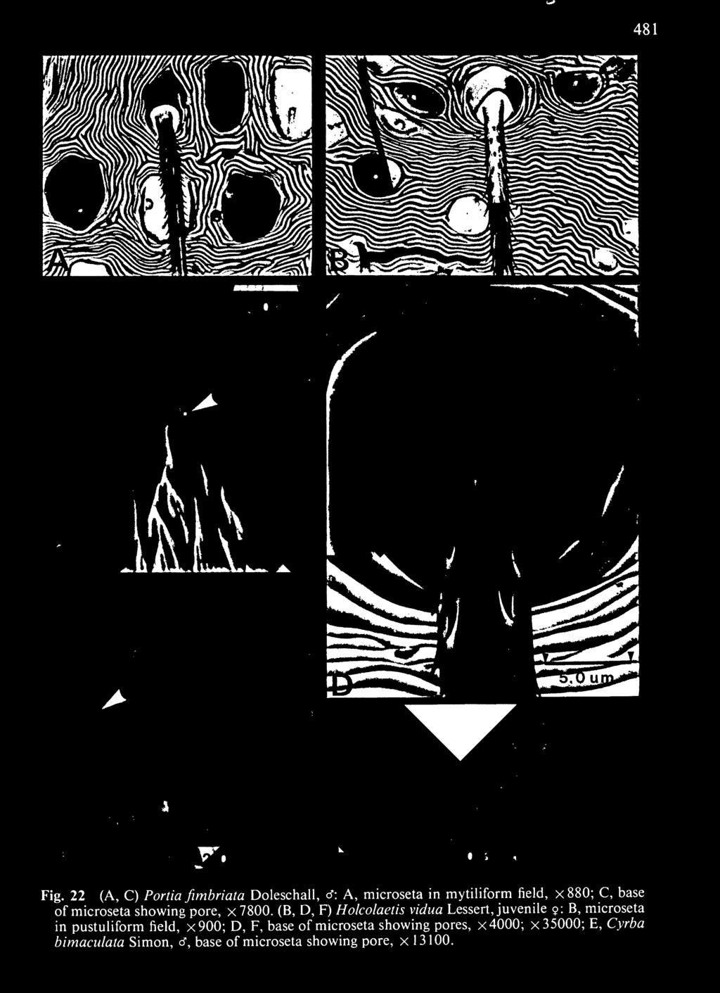 microseta in pustuliform field, x900; D, F, base of