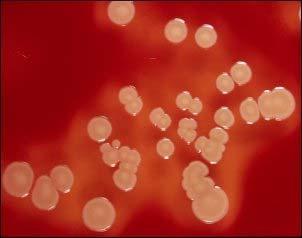 Staphylococcus aureus TSA β-hemolytic