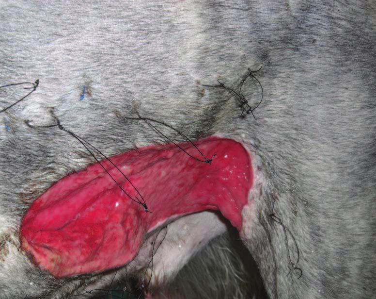The large skin flap was suture in place trying to preserve as much skin as possible.