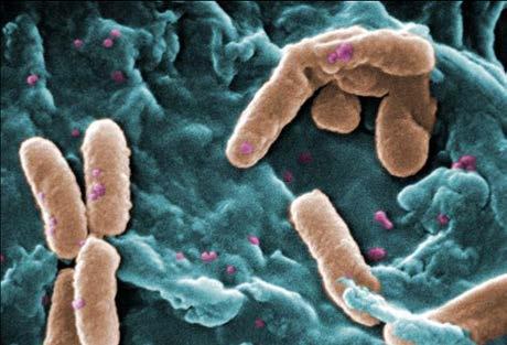 Antibiotics for MDR E. coli UTI Remember when all Haemophilus and all E. coli were susceptible to ampicillin?