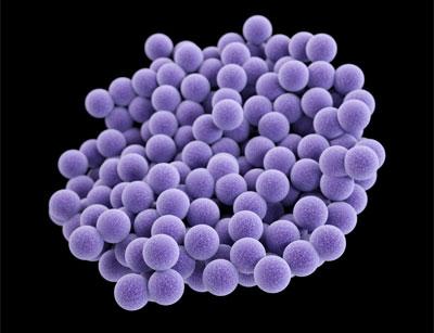 What are the most likely pathogens?