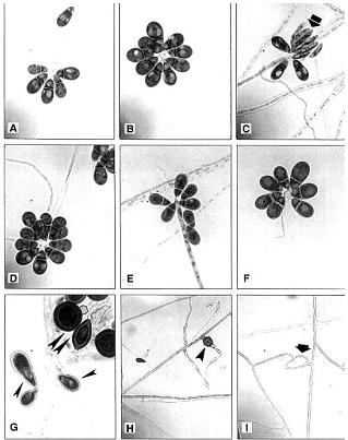 Shams Ghahfarokhi et al. of the heavily contamination with saprophytic fungi which were present in the samples, specially the fungus Fusarium oxysporum (Fig. 2).