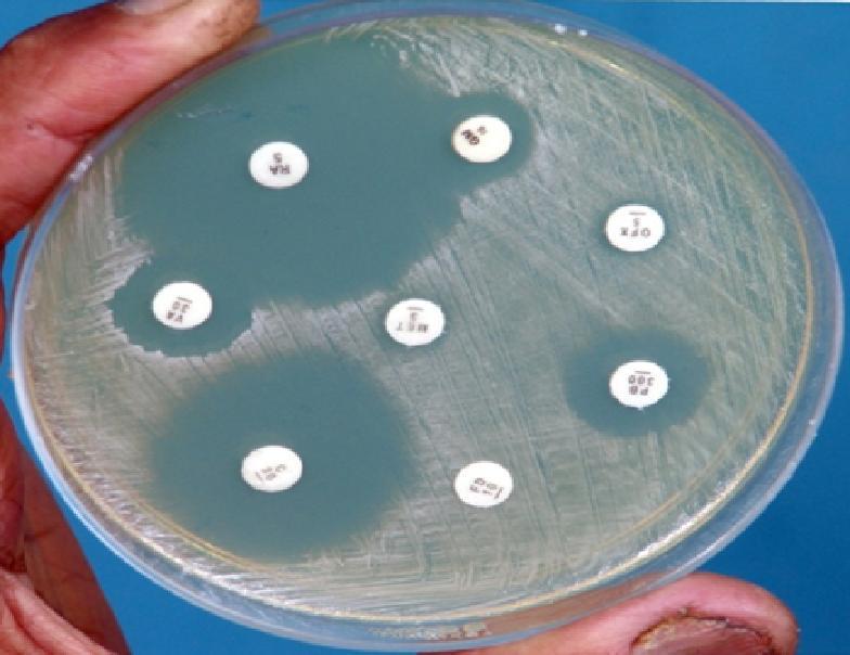 The aim of this work: is to detect different bacteria isolated from preoperative conjunctival swabs and to determine the prevalence of methicillin-resistant Staphylococcus aureus (MRSA) and