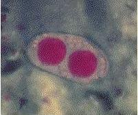 15 μm wide Transparent Oval Young oocyst contains two sporoblasts.