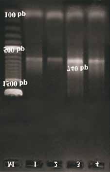 contortus, Lane M : 100 bp DNA ladder, Lane 1 : Rohilkhand strain, Lane 2 : Jhansi strain, Lane 3 : Jaunpur strain, Lane 4 : Varanasi strain Table-1: Genotyping of larvae of H.
