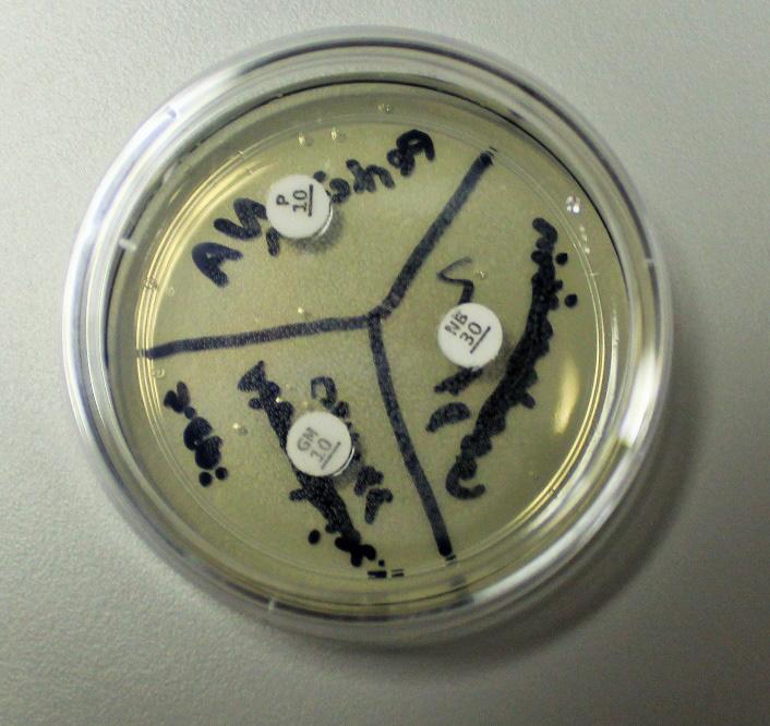 Figure 8. Antibiotic disks applied to plate. 22. Place the plate agar-side up in your incubation location and incubate for 48 hours. 23. Return the culture vial to your incubation location. 24.