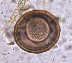 Parascaris univalens (ex- equorum) Ascarid/ large roundworm Bad