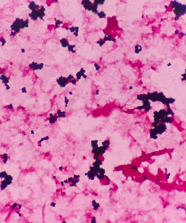 stain Staphylococcus aureus Beta