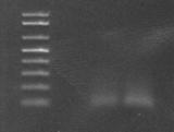 RNA iscript TM cdna synthesis Kit cdna PCR Primer F, R 140 b.p. Thermal cycle 30 cycles under 55 annealing temperature Electrophoresis (Gel 1) RT-PCR 1000 b.p. 850 b.p. 650 b.p. 500 b.p. 400 b.p. 300 b.