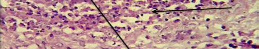 The staining of smears by gram stain have been showed the characteristic form of