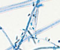 (5-7) Microsporum canis Microsporum gypseum Microsporum nanum Microsporum gallinae Human: 3% (mostly children,