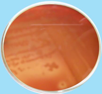 Molecular detection and characterization of Staphylococcus aureus RESULTS AND DISCUSSION 20 raw milk samples were analyzed in the laboratory by different cultural, biochemical, staining and molecular