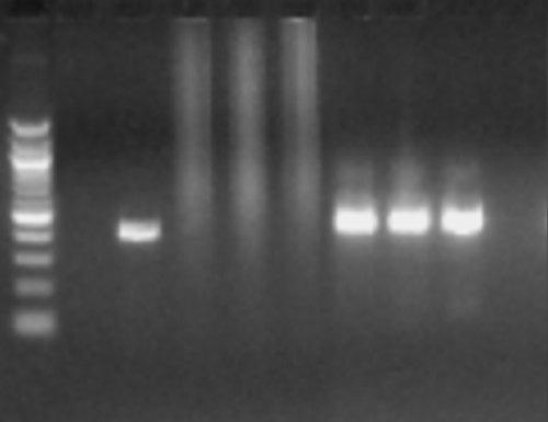 CHAPTER 3 RESULTS A total of 385 felid samples were screened (Table 3). DNA was successfully extracted, amplified and PCR amplicons were tested prior to the RLB assay.