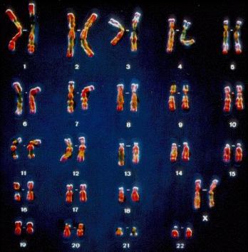 Sex Chromosomes & Autosomes Thomas Hunt Morgan s