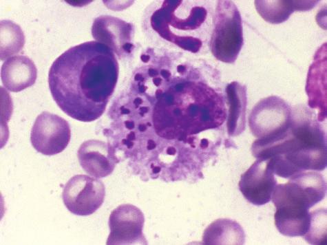 Reports in people and dogs indicate that BMBT is prolonged with thrombocytopenia at concentrations <100 10^9/L and <20 10^9/L, respectively (Jergens et al., 1987).