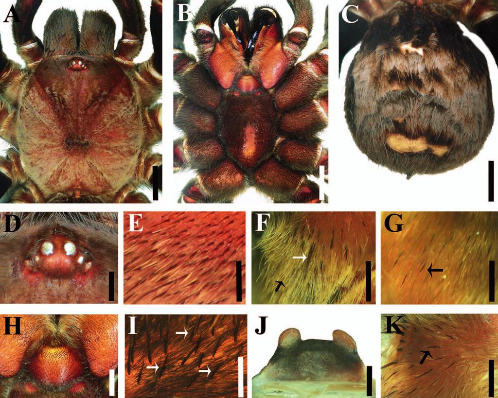 86 JOURNAL OF ARACHNOLOGY Figure 13. Crassicrus tochtli sp. nov. female paratype: A. Carapace. B. prosoma, ventral view. C. Abdomen, dorsal view. D. Ocular tubercle. E.