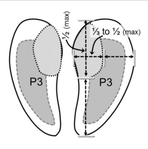 Lameness, Hoof and Leg Issues in Dairy Cows 81 Figure 3. Schematic of soles of claw showing area to be sloped.