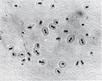Cell Surface Structure Capsule polysaccharide Completely envelops the pneumococcal cells. During invasion; the capsule is an essential determinant of virulence.