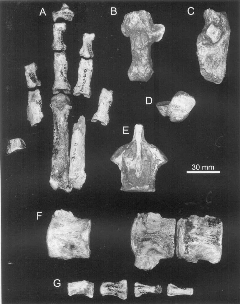 - DINOFELIS (MAMMALIA, FELIDAE) 167 Figure 14. Thoracic. Pelvic and axial skeleton elements of KNM-ER 4419 from the Upper Burgi Member, Koobi Fora Formation, Kenya. A, right manus.