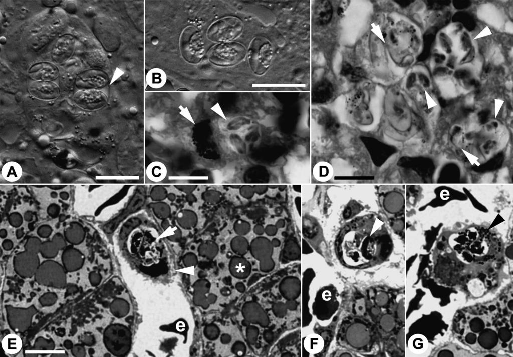 Jirkºu & Modr): Extra-intestinal Goussia oocysts in tadpoles 239 Fig. 1. Goussia sp. infecting Rana dalmatina. Micrographs of oocysts in the liver of tadpoles.