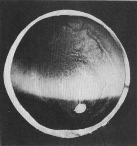 EQUINE VETERINARY JOURNAL 19 Fig. 23. Normal Ocular Fundus Showing Extent of Tapetum. u Fig. 21. Retina (Tapetum Lucidum).
