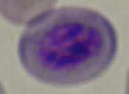 shaped, pale pink cytoplasm Immature Larger, darker