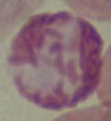cytoplasm, segmented nucleus, purple pink granules