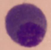 border Round round nucleus, dark purpleblue distinct