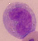 cytoplasm has tie dye appearance, round to oval